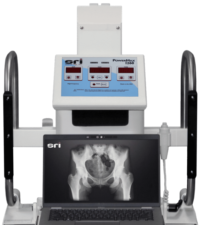 Buy Source-Ray PowerMax 1260 Digital X-ray machine